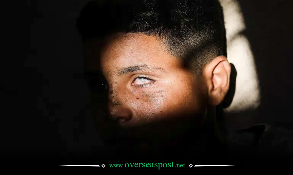 غزہ میں اسرائیلی شیلنگ کا شکار معصوم بچہ عادل راجہ العشی اور تباہ کاری کے مناظر