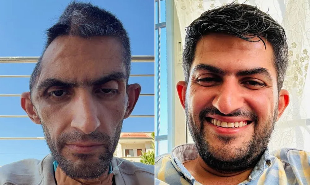 اسرائیلی جیل میں بدترین تشدد کا شکار ہونے والے فلسطینی صحافی کا خاکہ